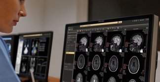 Philips IntelliSpace Portal Add On CCU
