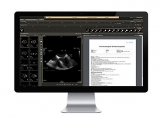 Philips IntelliSpace Cardiovascular - Echo workflow